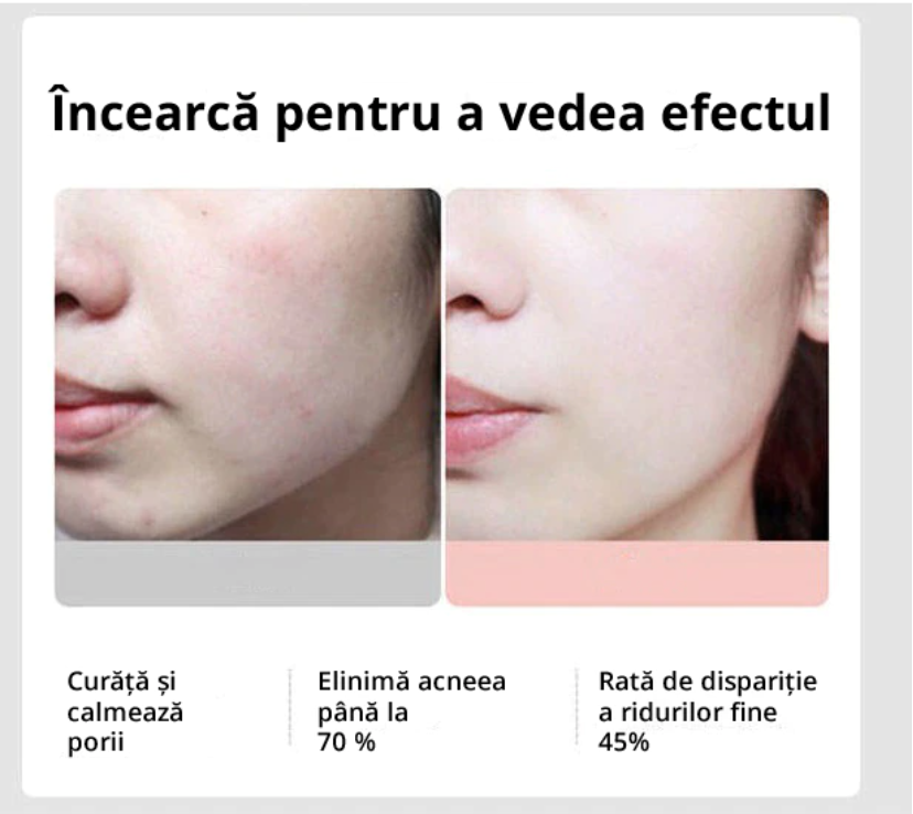 Aparat pt Tratament Facial + Intinerirea Pielii 5 in 1 - imagine 8