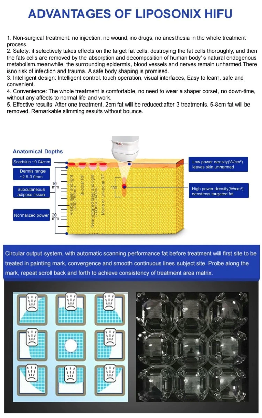 Aparat Cosmetic Profesional, Liposuctie Virtuala Lifting, Remodelare Corporala - imagine 10