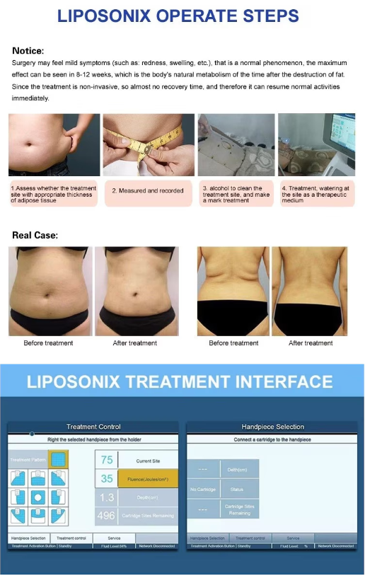 Aparat Cosmetic Profesional, Liposuctie Virtuala Lifting, Remodelare Corporala - imagine 13