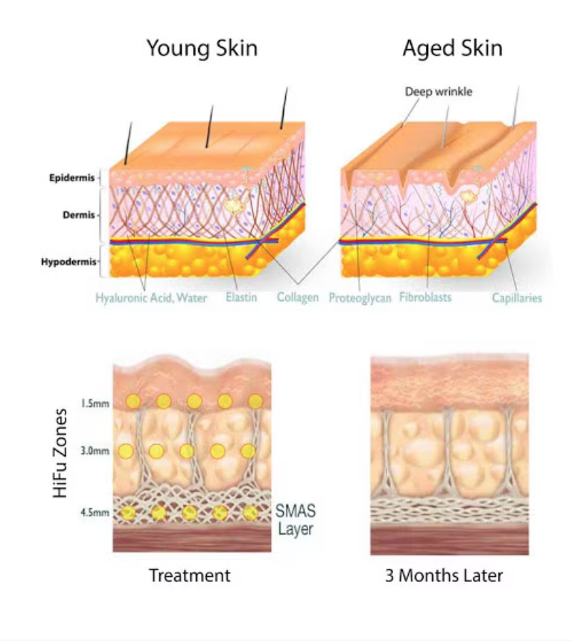 Aparat Cosmetic Profesional, Liposuctie Virtuala Lifting, Remodelare Corporala - imagine 22