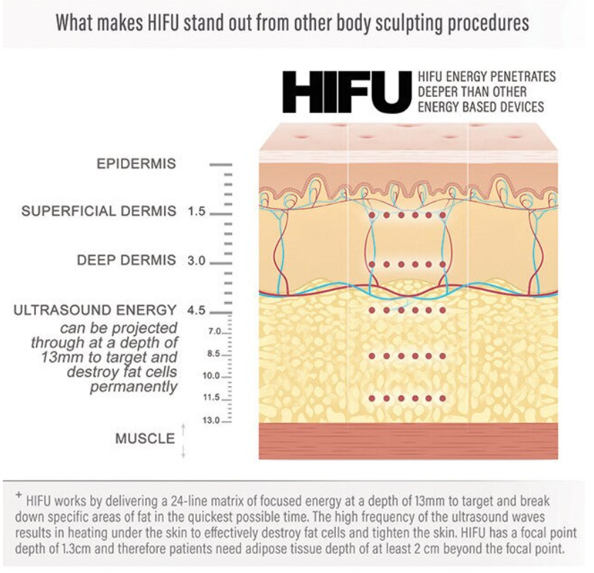 Aparat Cosmetic Profesional, Liposuctie Virtuala Lifting, Remodelare Corporala - imagine 23