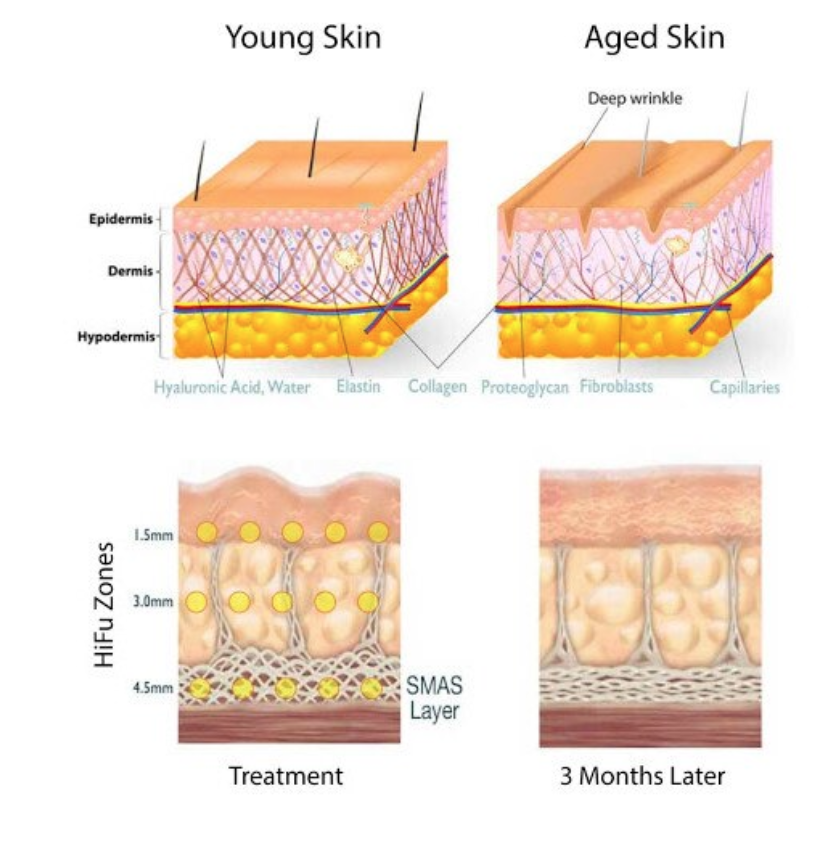 Aparat Cosmetic Profesional, Liposuctie Virtuala Lifting, Remodelare Corporala - imagine 24